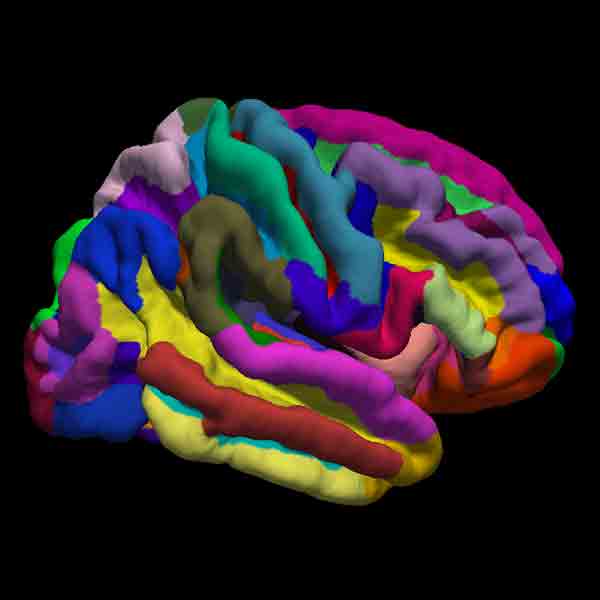 حجم‌سنجی مغز و ساختارهای آن (Volumetry)